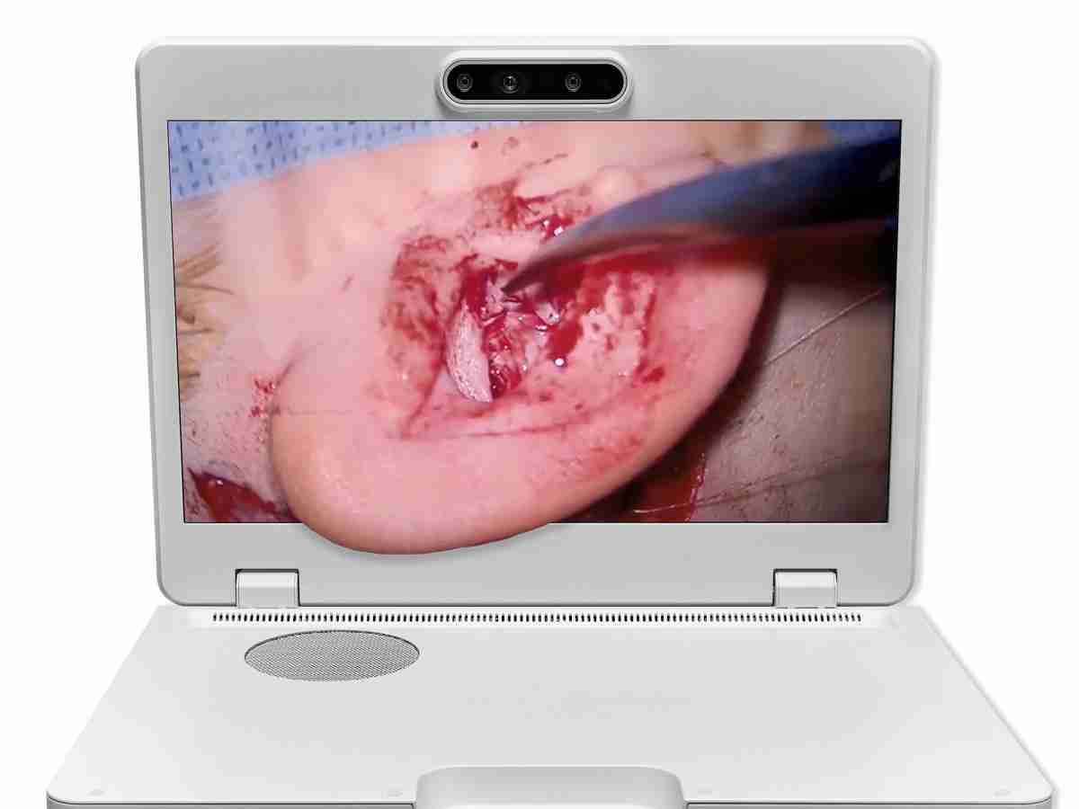 达擎之＂Heads-up 3D显微手术显示系统＂，，，，整合4K裸眼3D显示及眼球追踪系统，，，具备快速追踪人眼移动位置功能，，减轻医师长时间维持固定姿势的负担，，让医师能有更宽广清晰的3D立体视野及更舒适的姿势来执行手术。。